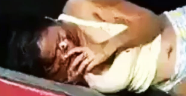 Kobieta po wypadku, dosłownie ściąga swoją zniekształconą twarz jak maskę